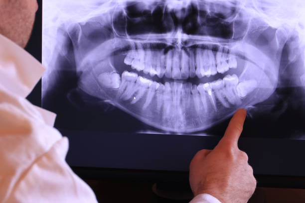 Best Broken Tooth Emergency  in Canton, IL